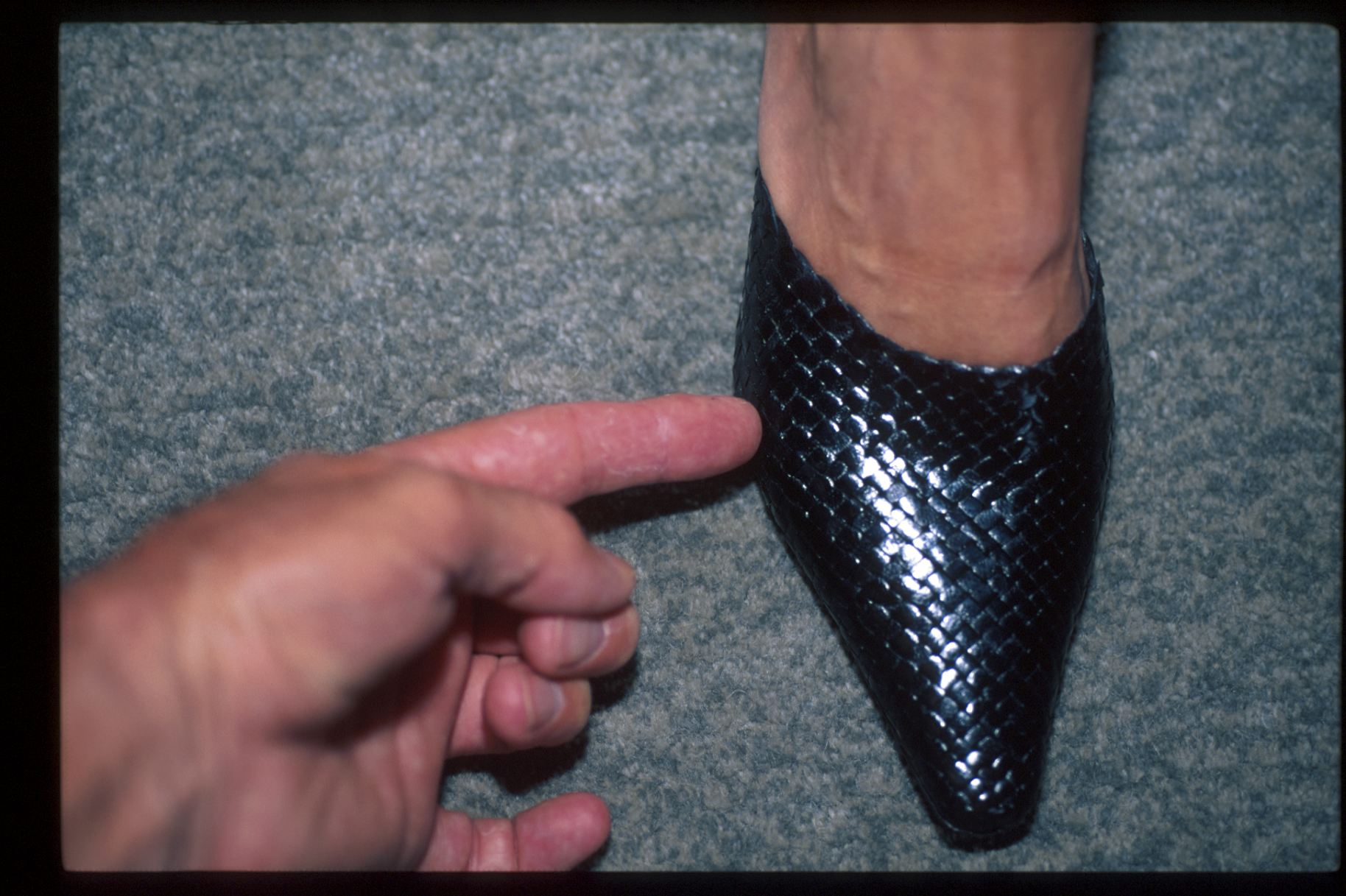 chaussures femme pour orteil en griffe